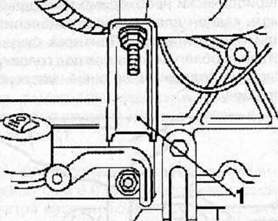 Disconnect the support (1) from the intake manifold and cylinder block.